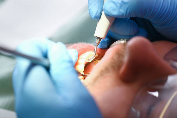 Tooth Infection Emergency Dentist in MI