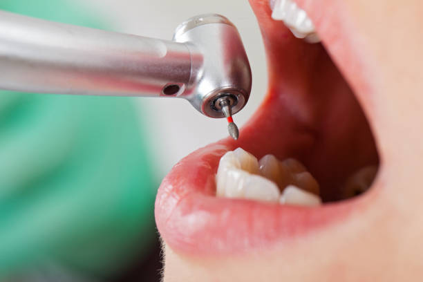 Best Cracked Tooth Emergency Dentist  in Edwardsburg, MI